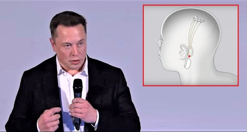 Elon Musk połączy mózg z komputerem?