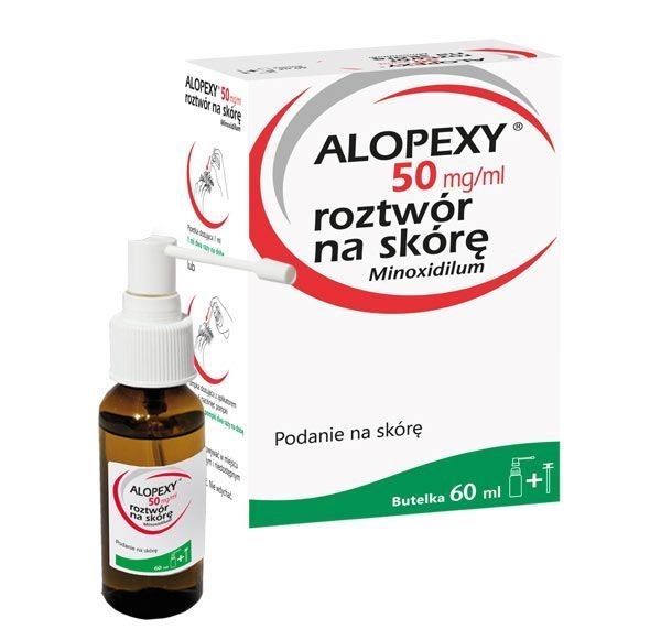 Alopexy na łysienie